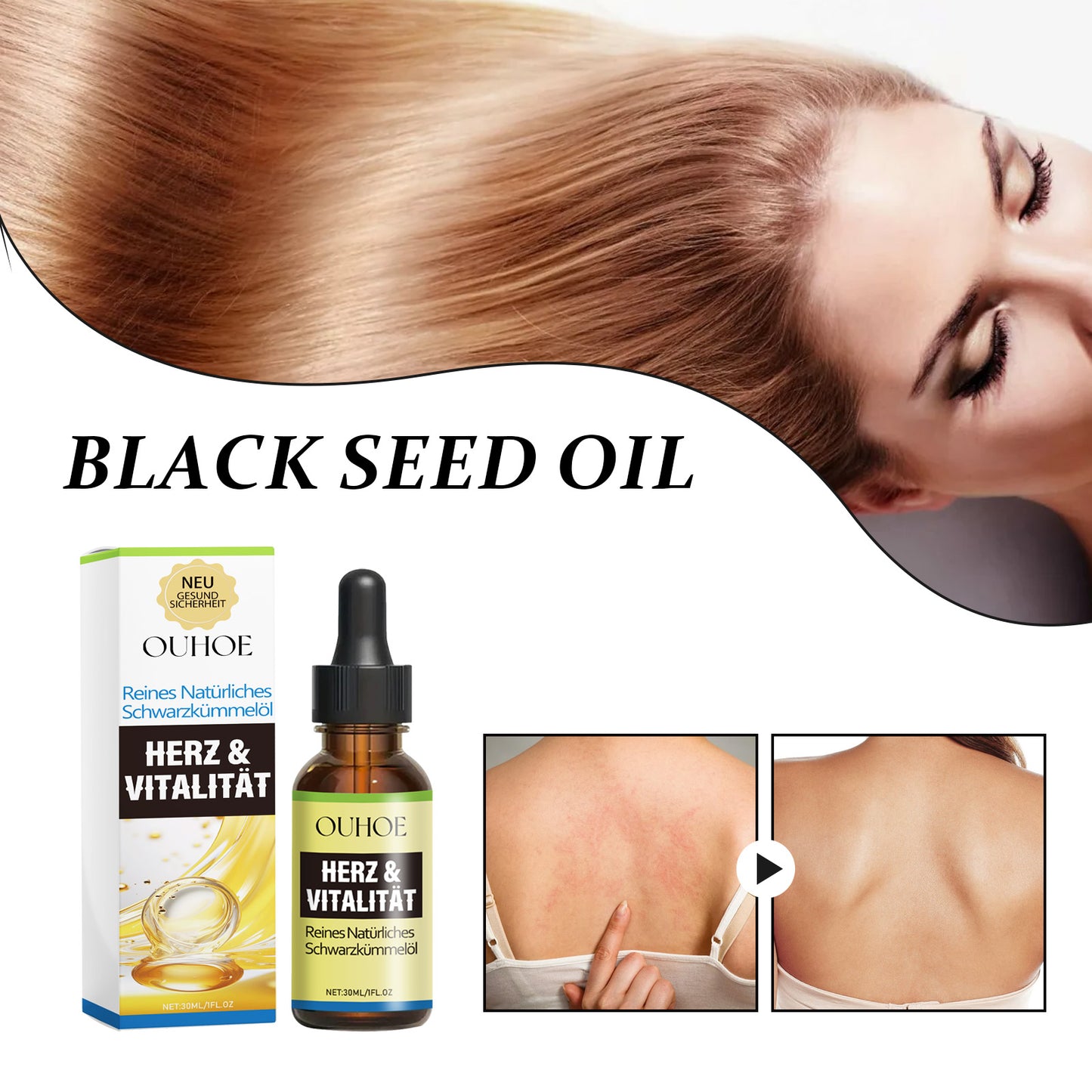 OUHOE Natural Black Seed Oil, Repair And Prevent The Loss Of Solid Hair Dense Hair Skin Itchy Redness Peeling Care Essence