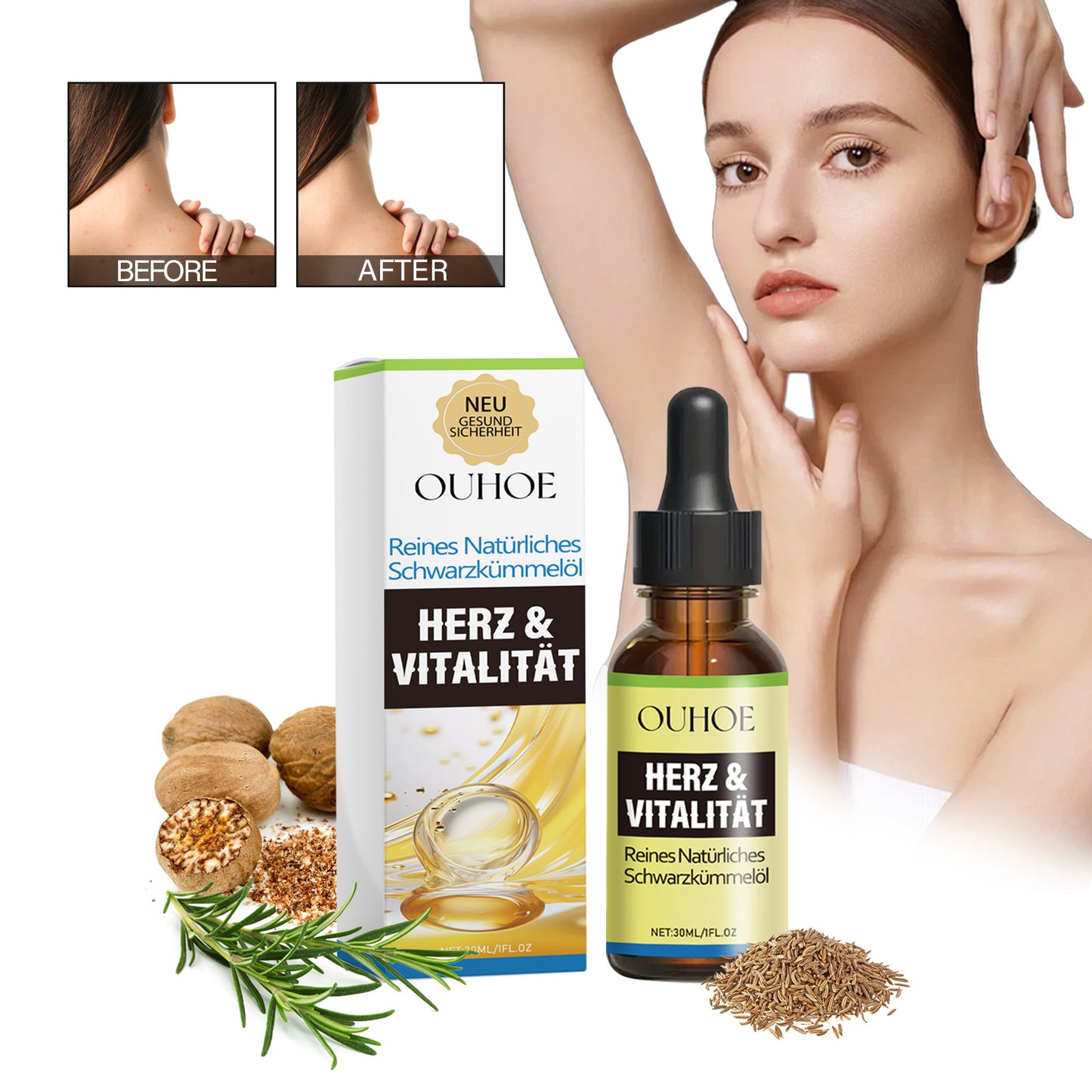 OUHOE Natural Black Seed Oil, Repair And Prevent The Loss Of Solid Hair Dense Hair Skin Itchy Redness Peeling Care Essence