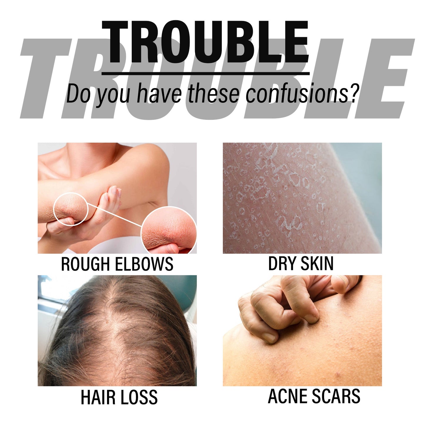 OUHOE Natural Black Seed Oil, Repair And Prevent The Loss Of Solid Hair Dense Hair Skin Itchy Redness Peeling Care Essence